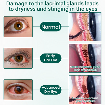 LUMIVO™ OptiClear Nano Eye Roller Serum