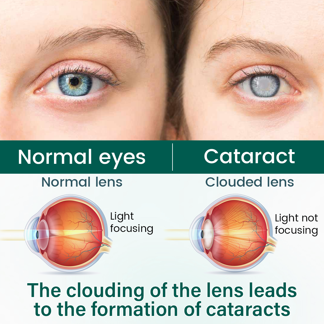 LUMIVO™ OptiClear Nano Eye Roller Serum