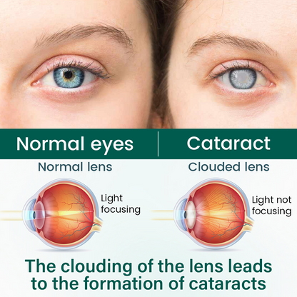 LUMIVO™ OptiClear Nano Eye Roller Serum